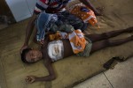 Rohingya's Wounded Children in Bangladesh